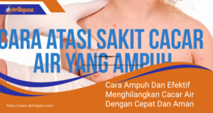 Cara Ampuh Dan Efektif Menghilangkan Cacar Air Dengan Cepat Dan Aman