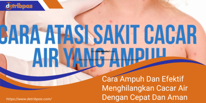 Cara Ampuh Dan Efektif Menghilangkan Cacar Air Dengan Cepat Dan Aman