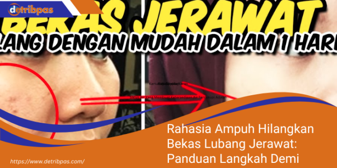 Rahasia Ampuh Hilangkan Bekas Lubang Jerawat Panduan Langkah Demi Langkah