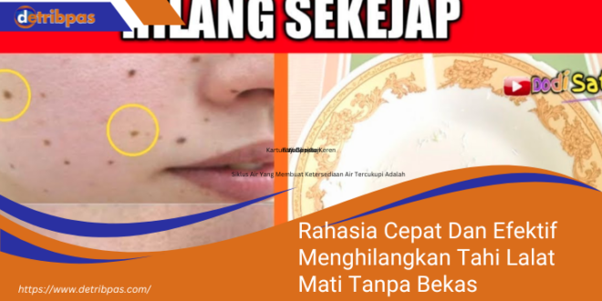 Rahasia Cepat Dan Efektif Menghilangkan Tahi Lalat Mati Tanpa Bekas