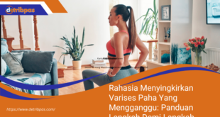 Rahasia Menyingkirkan Varises Paha Yang Mengganggu Panduan Langkah Demi Langkah