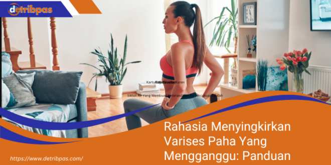 Rahasia Menyingkirkan Varises Paha Yang Mengganggu Panduan Langkah Demi Langkah