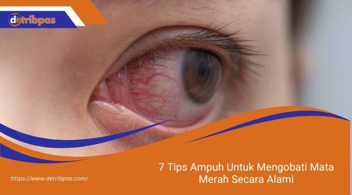 7 Tips Ampuh Untuk Mengobati Mata Merah Secara Alami