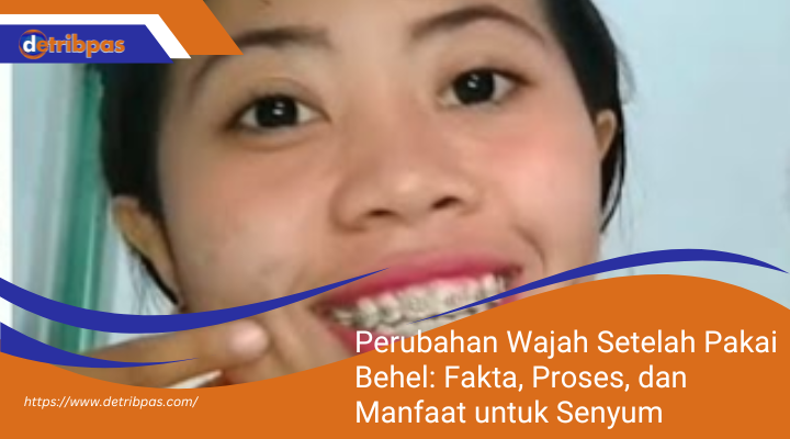 Perubahan Wajah Setelah Pakai Behel: Fakta, Proses, dan Manfaat untuk Senyum Lebih Indah